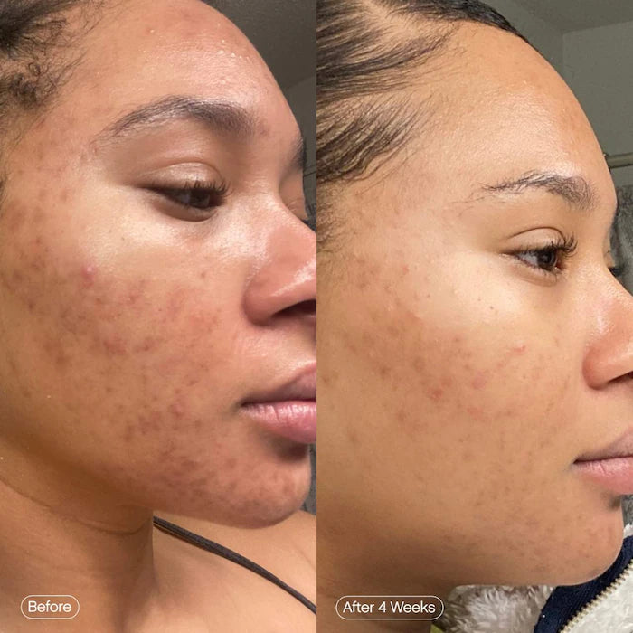 Topicals
Faded Serum for Dark Spots & Discoloration