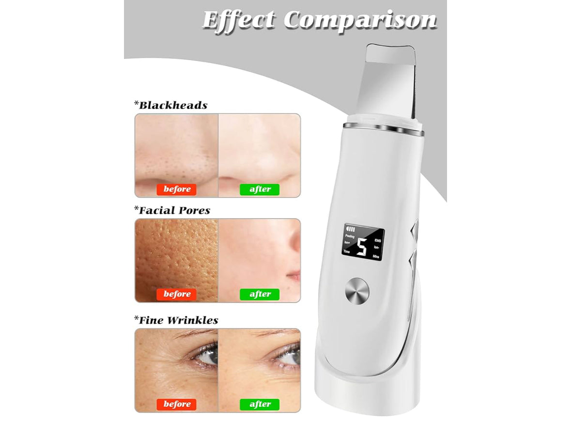 Beauenty Ultrasonic Skin Scrubber Face Spatula, Skin Spatula Pore Cleaner, Skin Dirt Blackhead Remover Tools for Facial Deep Cleansing - 4 Modes (White)