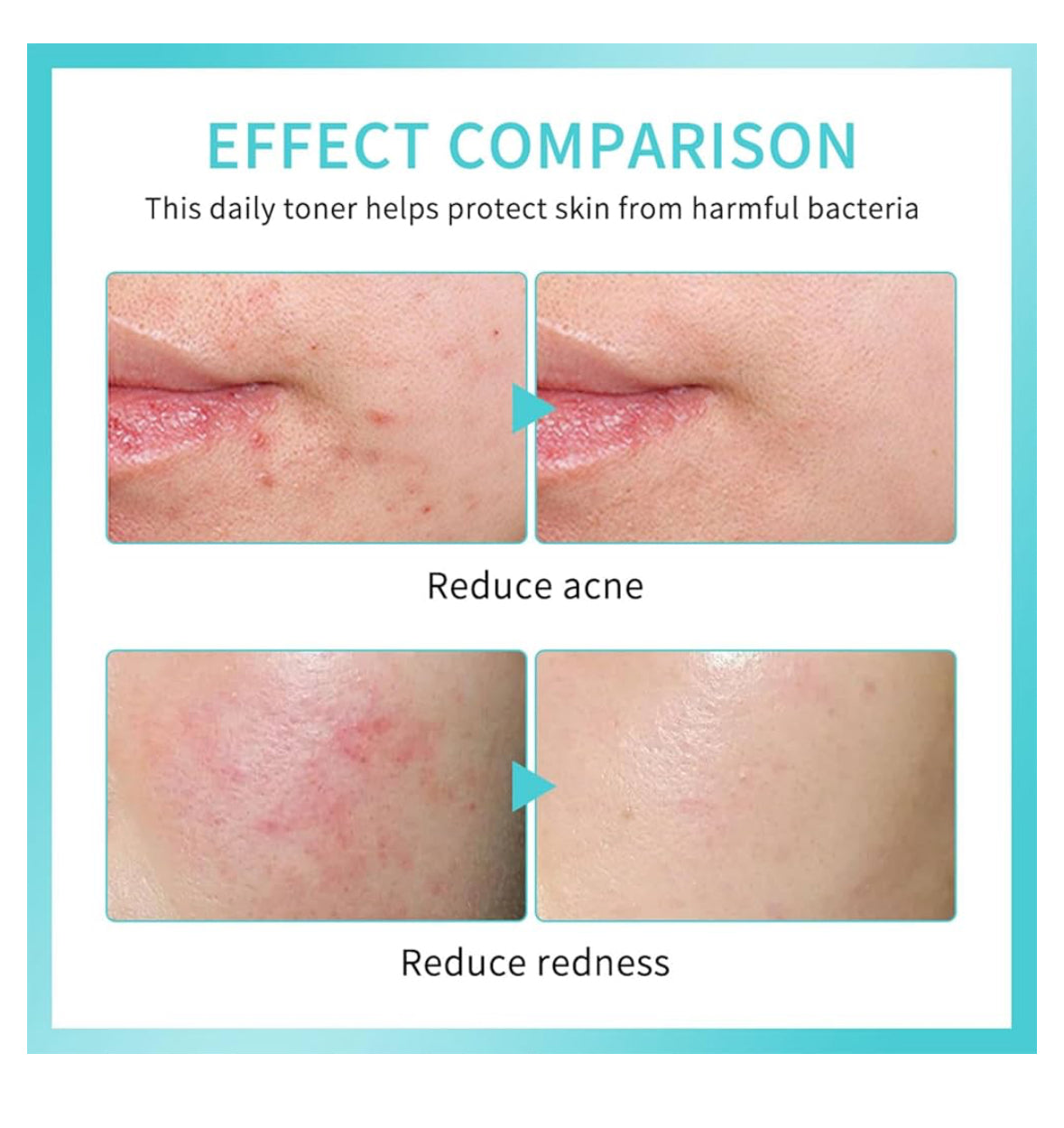 Getaria Hypochlorous Acid Spray for face, Daily Rescue Facial Spray, Toner Soothing and Purify, Facial Mist, Support Against Irritation, Calm Redness