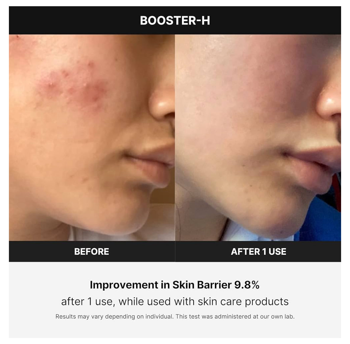 Medicube Age-R Booster H