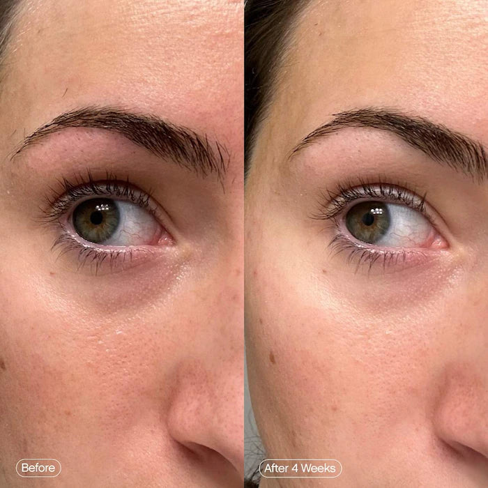 Topicals
Faded Under Eye Brightening & Clearing Eye Masks