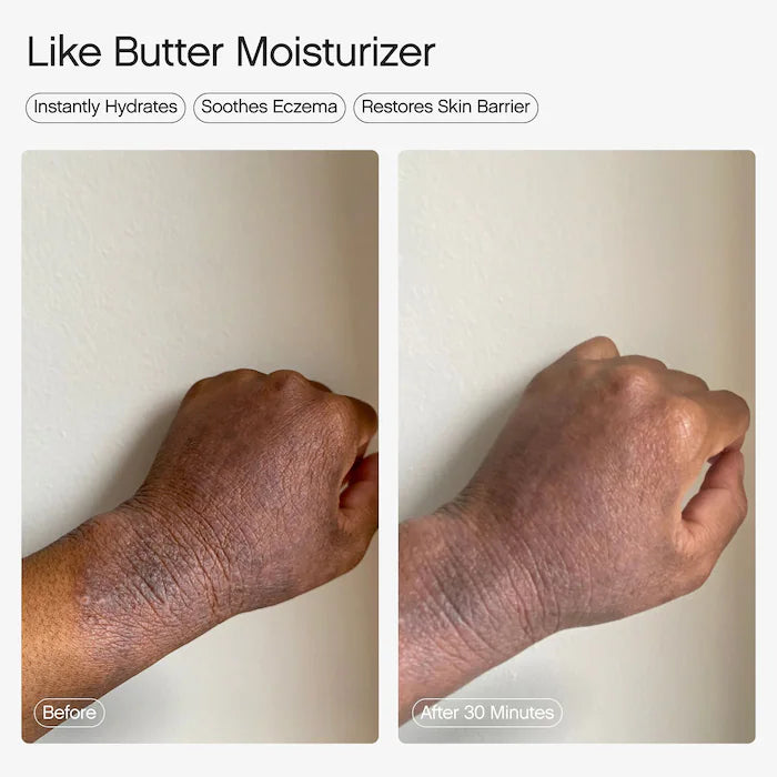 Topicals
Like Butter Moisturizer for Dry, Sensitive & Eczema-Prone Skin